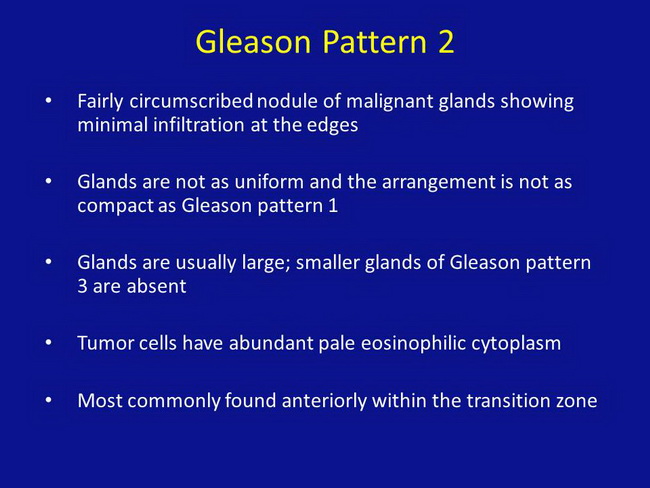 Gleason Pattern 2_Resized.jpg